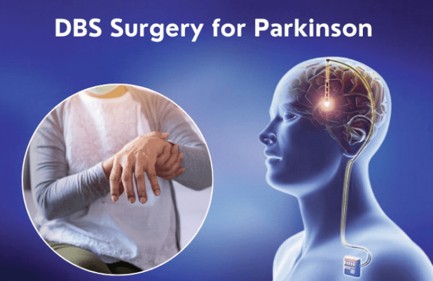DBS Surgery for Parkinson’s: How It Works and Who Can Benefit