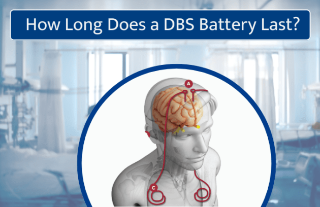 How Long Does a DBS Battery Last? Everything You Need to Know