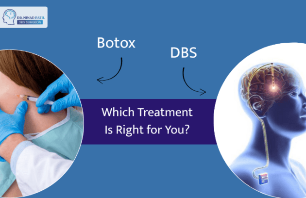 DBS vs Botox for Dystonia: Which Treatment Is Right for You?