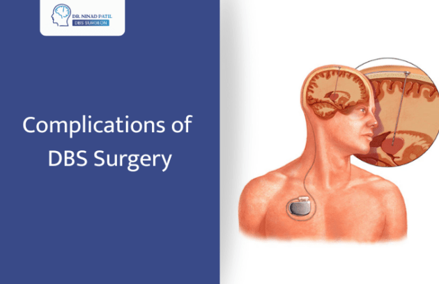 What are the complications of DBS surgery?