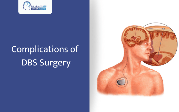 What are the complications of DBS surgery?