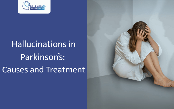 What Causes Hallucinations in Parkinson’s and How to Treat Them