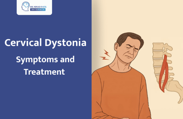 Cervical Dystonia (Spasmodic Torticollis): Symptoms and Treatment