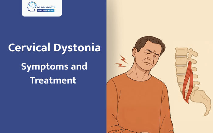 Cervical Dystonia (Spasmodic Torticollis): Symptoms and Treatment