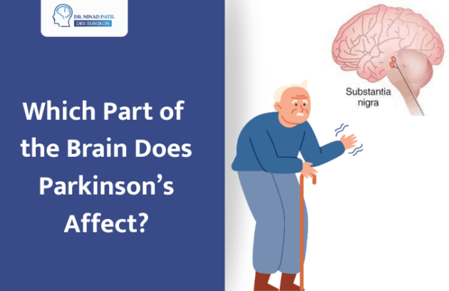 What Part of Your Brain Does Parkinson's Disease Affect?
