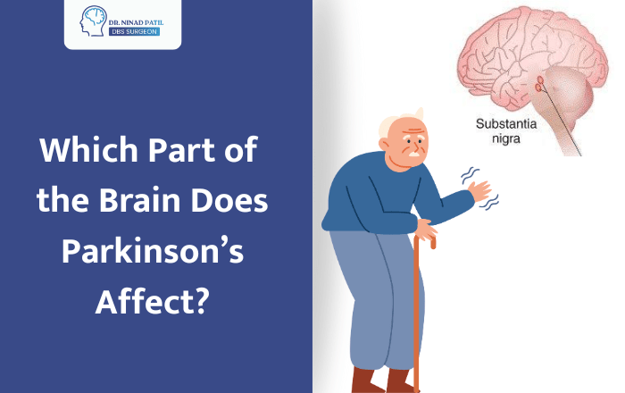 What Part of Your Brain Does Parkinson's Disease Affect? - Dr. Ninad Patil