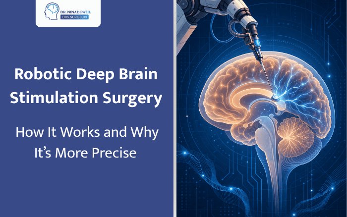 Robotic Deep Brain Stimulation Surgery: How It Works and Why It's More Precise