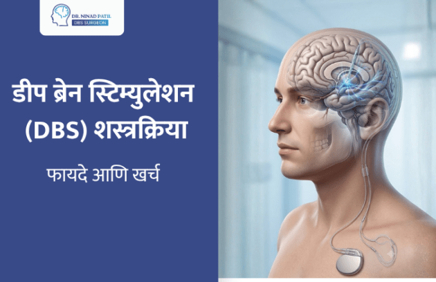 डीप ब्रेन स्टिम्युलेशन (DBS) शस्त्रक्रिया: फायदे आणि खर्च