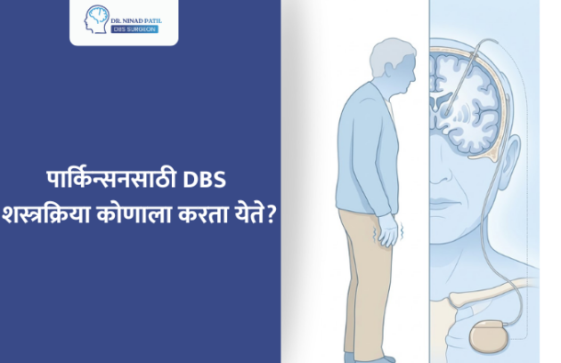 पार्किन्सनसाठी DBS शस्त्रक्रिया कोणाला करता येते?