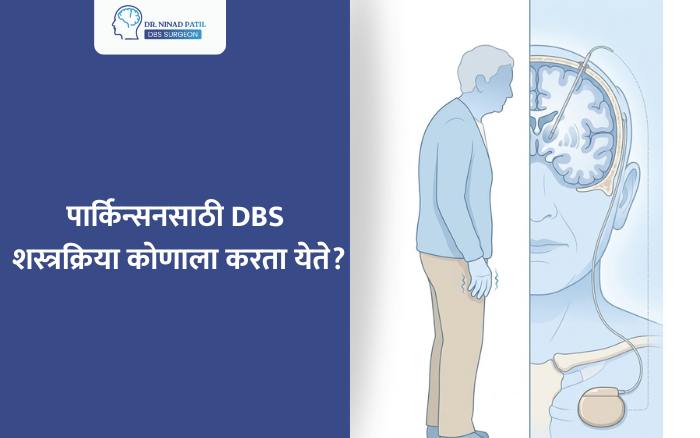 पार्किन्सनसाठी DBS शस्त्रक्रिया कोणाला करता येते?