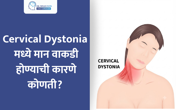 Cervical Dystonia मध्ये मान वाकडी होण्याची कारणे कोणती?